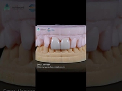 الطبيعية المضغوطة EMAX القوة 16 ظلال Emax الأسنان القشرة