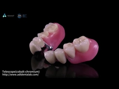 التلسكوب الداخلي Co-Cr والخارجية Co-Cr المعدن الجزئي مع المركب