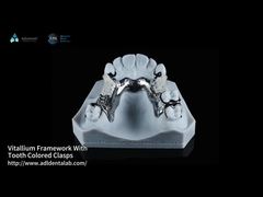 FDA Vitallium Framework With Tooth Colored Clasps For Natural Esthetics