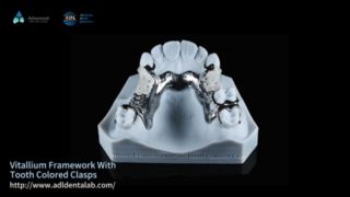 إطار فيتاليوم جماليات طبيعية سهلة التركيب