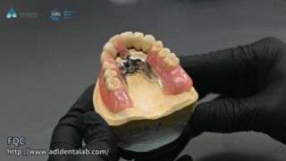 تاج التلسكوب