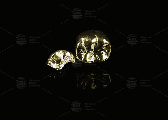 شراء سبيكة ثمينة ذهب أصفر 60% تاج معدني كامل ذهب النهاية تاج معدني كامل التصنيع عبر الإنترنت