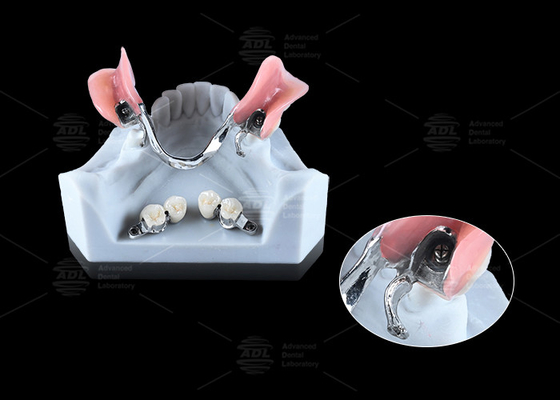 شراء 0.1mm التسامح CEKA REVAX التوصيل التيتانيوم 3mm الإفراج الرأسي التصنيع عبر الإنترنت