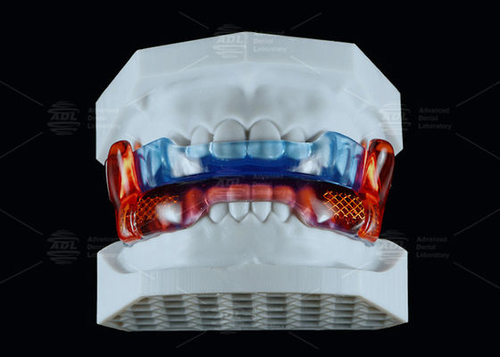 شراء جهاز مكافحة الشخير من الدرجة الطبية من السيليكون RP لتحسين النوم التصنيع عبر الإنترنت