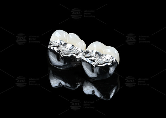 شراء Co Cr سيراميك PFM إعادة تأهيل Cad Cam Pfm Crown طبيعي المظهر التصنيع عبر الإنترنت