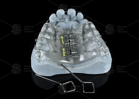 شراء مختبر الصين الأسنان الملونة الفولاذ المقاوم للصدأ المسمار الموسع لتكبير الفك والفك الصدغي التصنيع عبر الإنترنت