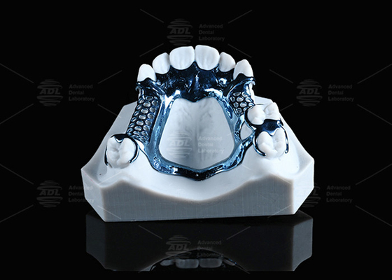 إطار التيتانيوم المطبوع بثلاثية الأبعاد خفيف الوزن ومناسب للبشرة الحساسة