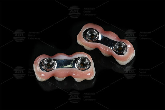 أداة التثبيت المُعزّزة CAD CAM مصممة لتناسب الدقة متوافقة مع معظم أنظمة زرع الأسنان تضمن حلول استعادة الأسنان